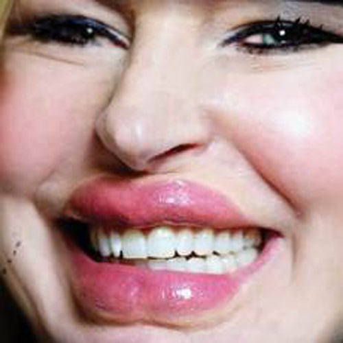 3D Botoxic Lips Special FX Transfer