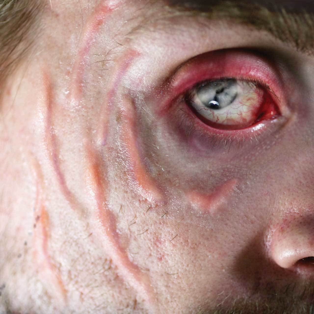 Healed Scars Special FX Transfer